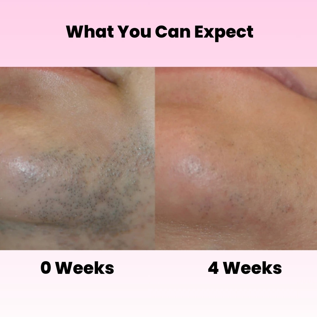 BareNow™ Hair Removal Oil