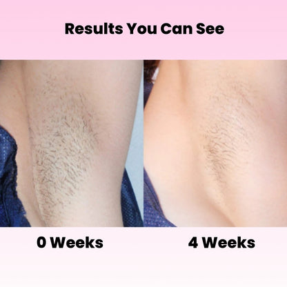 BareNow™ Hair Removal Oil