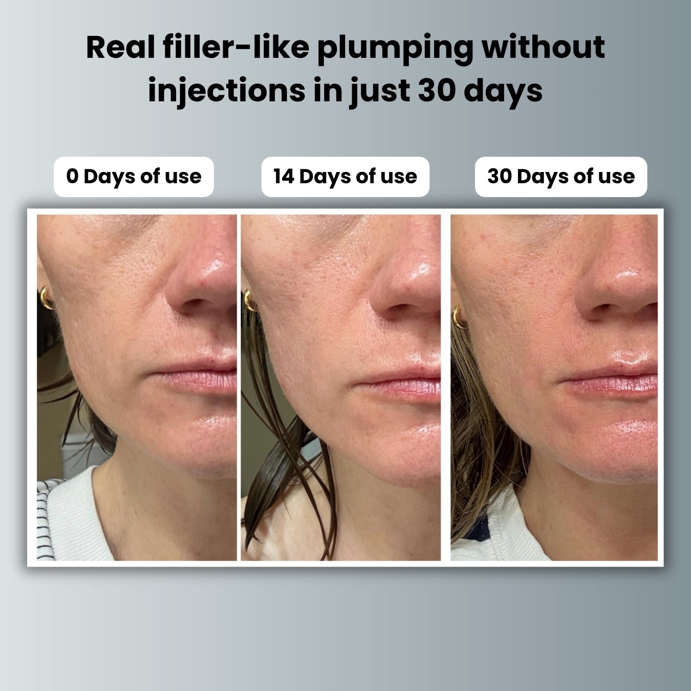 Liftera™ Plumping Serum
