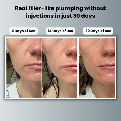 Liftera™ Plumping Serum