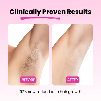 BareNow™ Hair Removal Oil