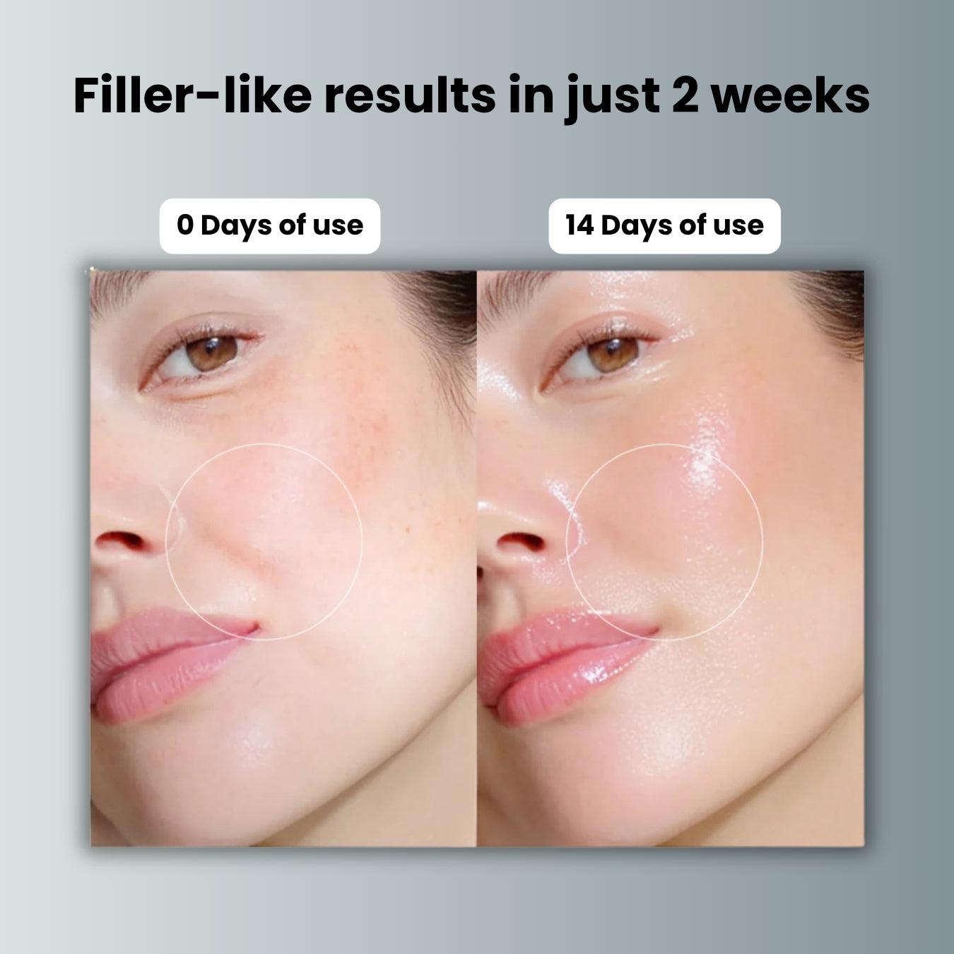Liftera™ Plumping Serum