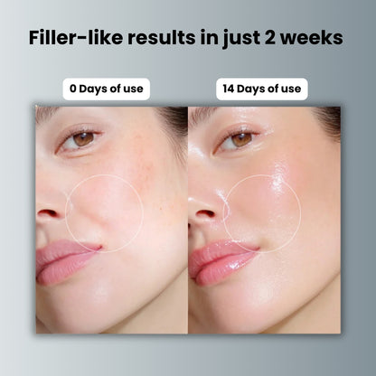 Liftera™ Plumping Serum